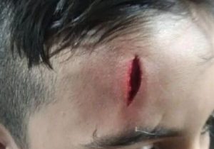 تنبیه بدنی دانش‌آموز خرم‌آبادی/ معلم لغو ابلاغ شد