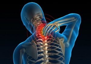 چه مواقعی مشکل گردن به شکل سردرد بروز پیدا می‌کند؟