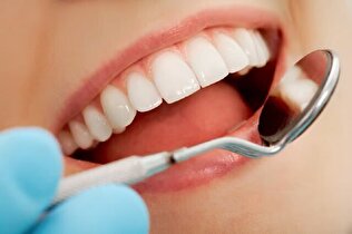 کدام مواد غذایی به سلامتی دندان‌ها کمک می‌کنند؟