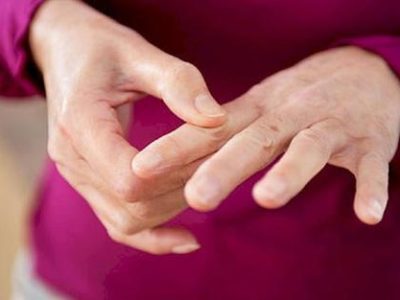 چرا زنان بیش از مردان به آرتریت روماتوئید دچار می‌شوند؟
