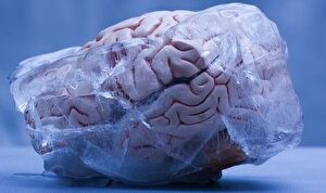 با این کار محققان چینی مغز انسان سوت می‌کشد