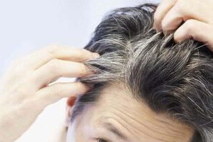 ویتامینی که مصرف آن از ریزش مو جلوگیری می‌کند