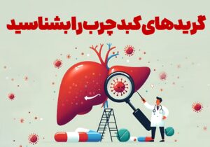 اینفوتابناک | گریدهای کبد چرب را بشناسید