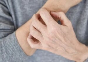 پوست شما چه بیماریهایی را لو میدهد